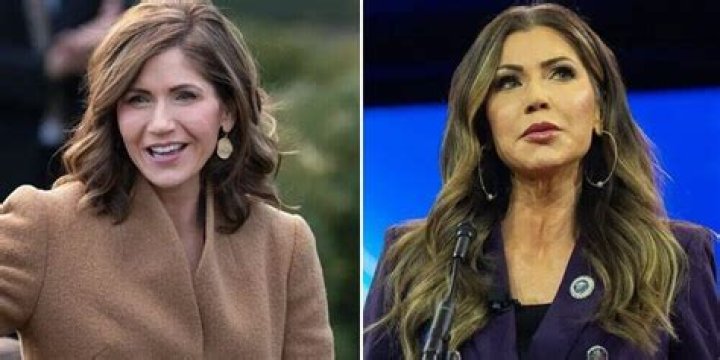 Meredith Duxbury Plastic Surgery: Before And After Photos